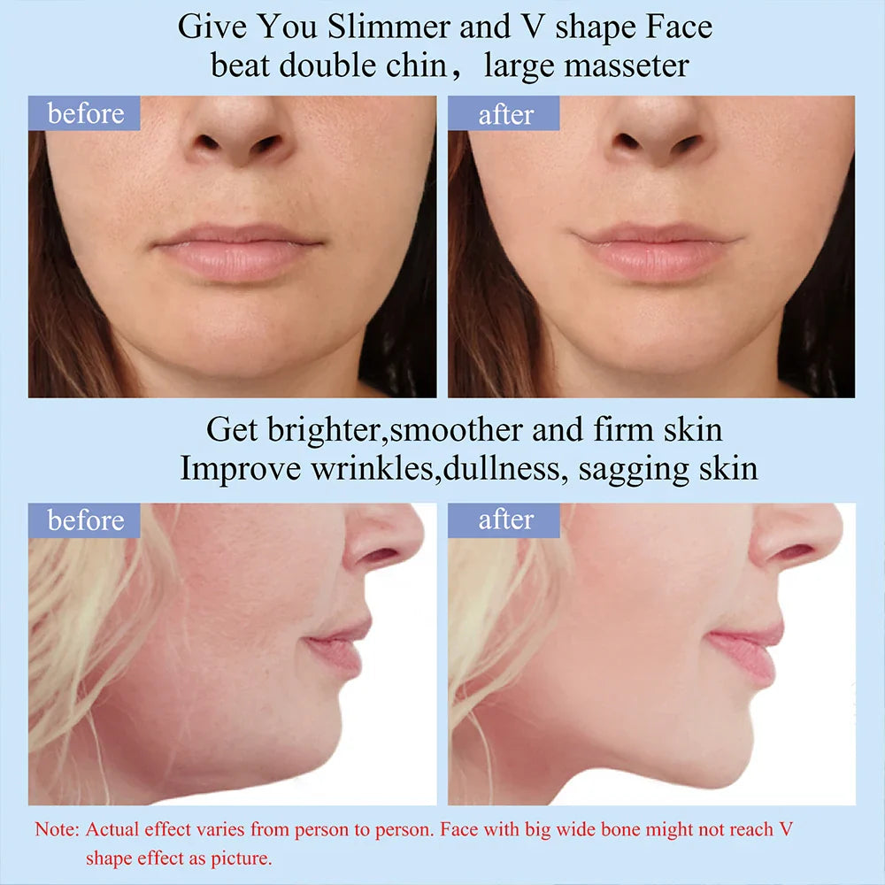 Produktnamn - EMS-lymfmassageapparat